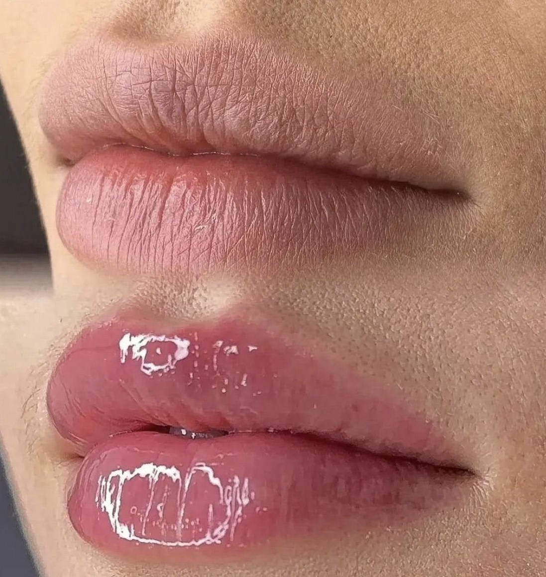 Hidra Gloss